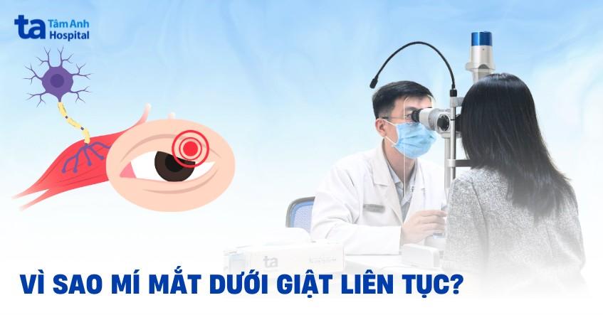 Vì sao mí mắt dưới bị giật liên tục nhiều ngày và cách chữa trị